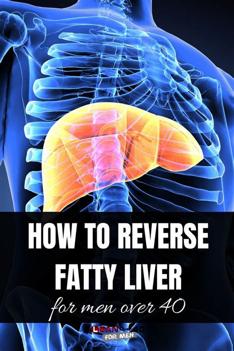 How To Reverse Fatty Liver Fatty Liver Fatty Liver Diet Fatty Liver