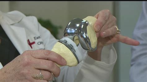 3d Knee Replacements Provide Customized Fit Less Pain Youtube