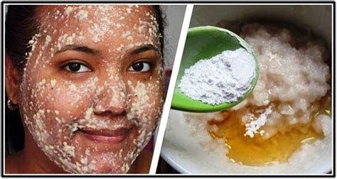 Hyperpigmentation Is A Harmless Skin Condition Which Causes Dark