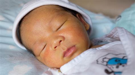 How Sunlight Can Help Your Jaundiced Newborn