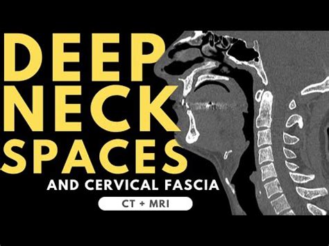 Deep Neck Spaces And Deep Cervical Fascia Anatomy Radiology Anatomy