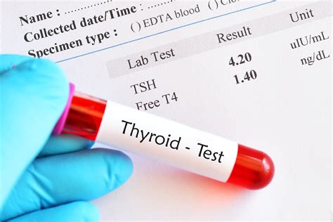 What Are Optimal Thyroid Levels Dr Michael Ruscio Dc