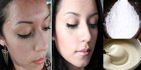How To Fair Skin Whitening Naturally Get Fair Glowing Spotless Skin In