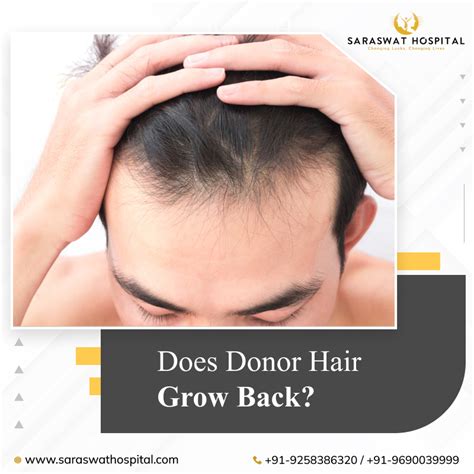 Does Donor Hair Grow Back After Fue Hair Transplant In India