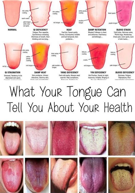 Tongue What Your Tongue Can Tell You About Your Health Great Diy Ideas Tongue Health