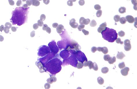 Filesmall Cell Lung Cancer Cytology Wikipedia