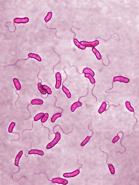 Vibrio Cholerae Bacterialm Bild Kaufen 12043026 Science Photo Library