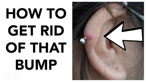 If Your Piercings Have Bumps Watch This Life Hack Youtube