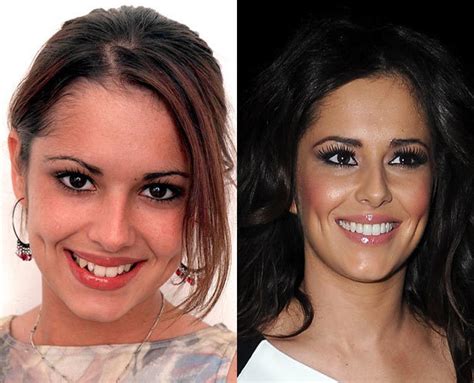 Cheryl Cole Tulisa Zac Efron Celebrity Teeth Before And After Celebrity News Digital Spy
