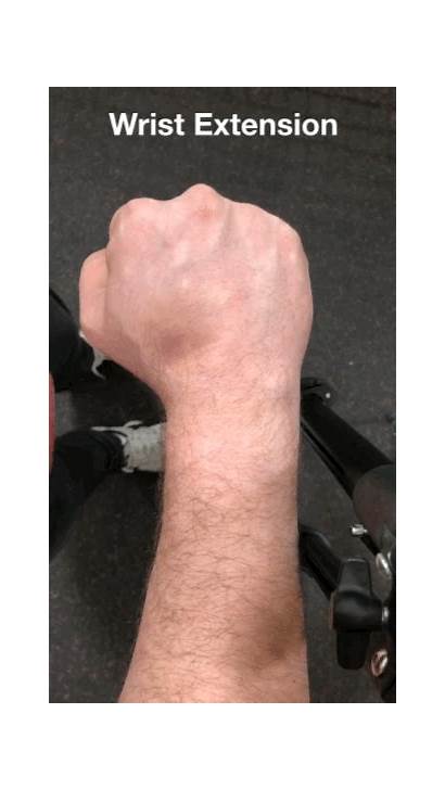 Wrist Extension Deviation Radial Hit Swing