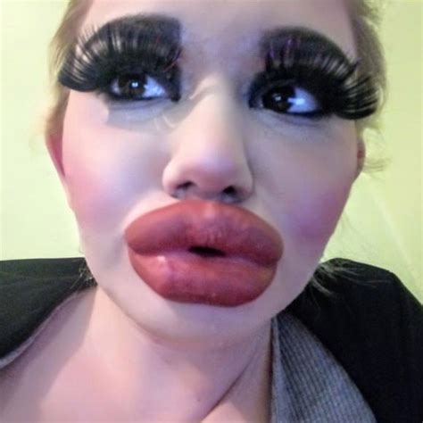 andrea ivanova has 17 lip injections to look like idol barbie herald sun
