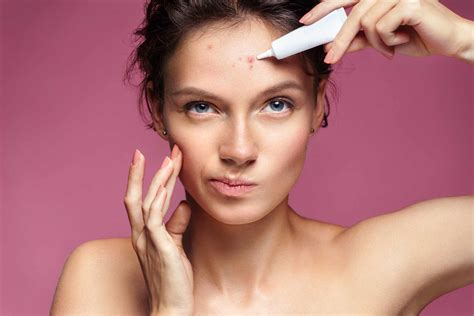 Should You Diy Acne Treatments A Short Guide