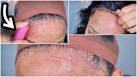 According to james, the easiest and least abrasive way to remove glue from hair is with an oil. Remove Your Lace Wig With Ease &+ Left Over Glue Residue ...