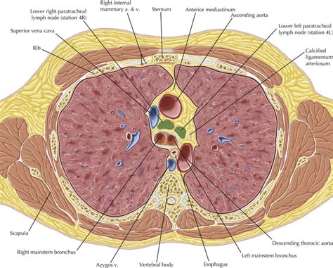 Thoracic Lymph Nodes Radiology Key