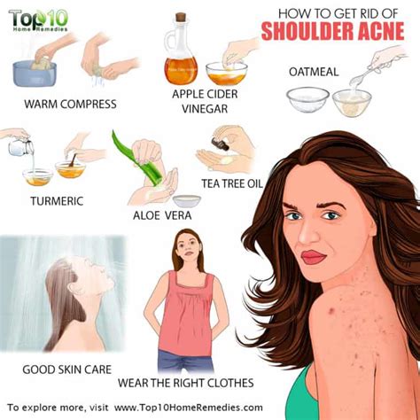 How To Get Rid Of Shoulder Acne Top 10 Home Remedies