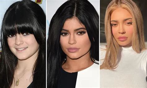 Kylie Jenner Before And After Pictures Of Transformation And Surgery