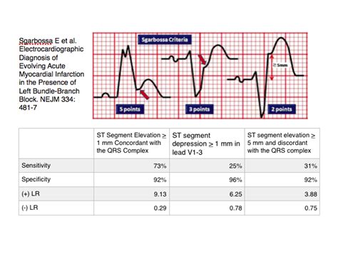 ST Elevation Myocardial Infarction In LBBB Core EM