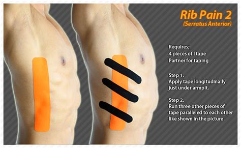 Rib Cage Muscles Pain Sharp Pain Under Right Rib Cage Hubpages In
