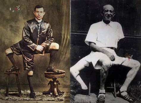 Frank Lentini The Curious Story Of The Man With Three Legs Random
