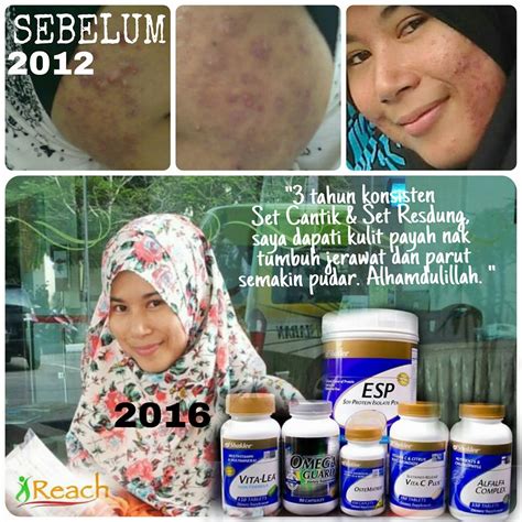 Berikut adalah senarai produk yang boleh korang cari. 7 Produk Hilangkan Parut Jerawat Hitam Dan Berlubang ...
