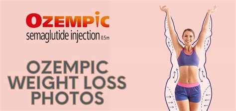Ozempic Butt What To Know About This Weight Loss Drug Side Effect My