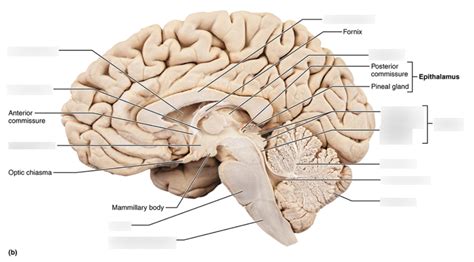 Midsagittal Section Of Brain Diagram Quizlet