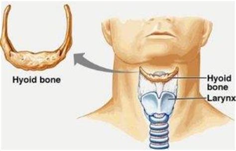 After More Than 20 Years, Man Finally Gets Diagnosis After 3D Printing