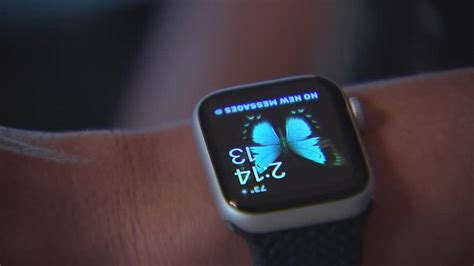 Customers Claim Apple Watch Caused Skin Irritation Injuries Boston