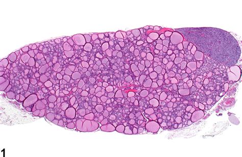 Its job is to produce and release two major hormones—thyroxine (t4) and triiodothyronine (t3). Thyroid Gland - Nonneoplastic Lesion Atlas
