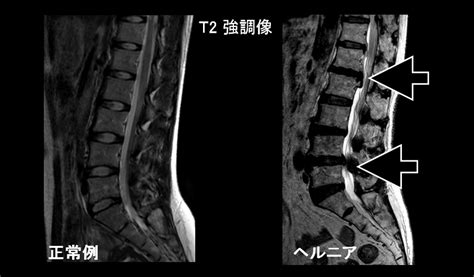 柔道整復師の方へ|がんの画像診断は宇都宮セントラル ...