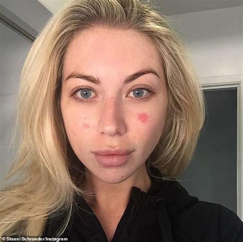 Stassi Schroeder Tells Fans To Send Help As She Bravely Reveals