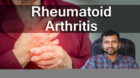 Rheumatoid Arthritis Dr Nilesh Patil Consultant Rheumatologist In