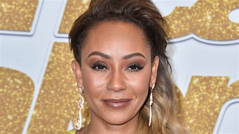 Spice Girl Mel B Went Blind In Her Right Eye On The Mend Now