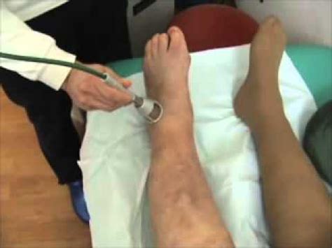 Edema post intervento per una frattura al malleolo tibiale ...