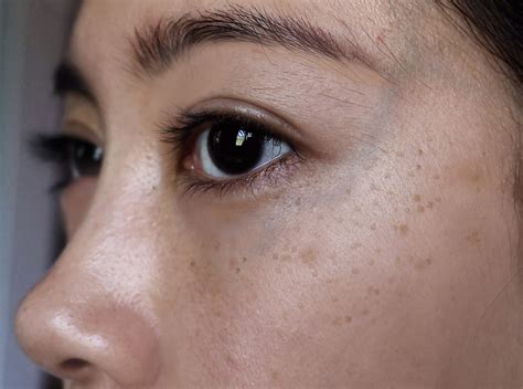 Dark Spots Removal Face Mask Remedy Makeup Vine