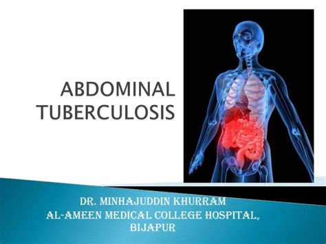 Abdominal Tuberculosis