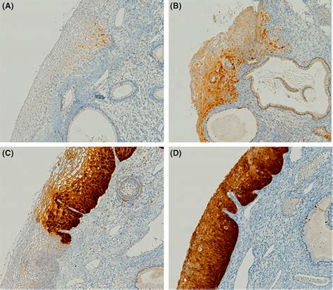 Representative Examples Are Shown For The P16ink4a P16 Immunostaining
