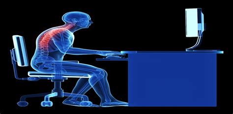 Explainer Can You Cure Bad Posture