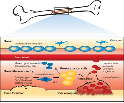 Bone Cell Biology And The Pathology Of Tumor Bone