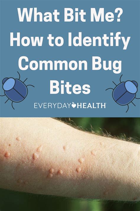 Difference Between Mosquito And Spider Bite Images Peepsburghcom