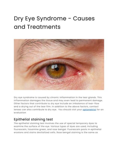 Dry Eye Syndrome Causes And Treatments