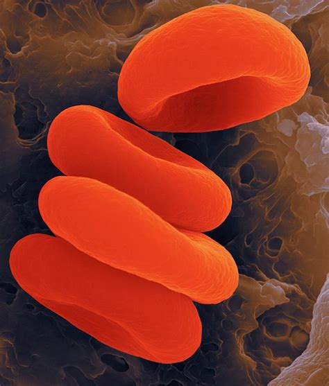 Red Blood Cells In The Rouleau Formation Photograph By Dennis Kunkel Microscopy Science Photo