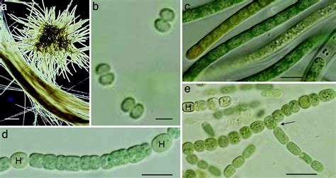 Species Of Cyanobacteria With Microscope Photos