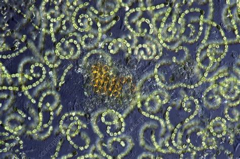 Anabaena Cyanobacteria Light Micrograph Stock Image C0289183