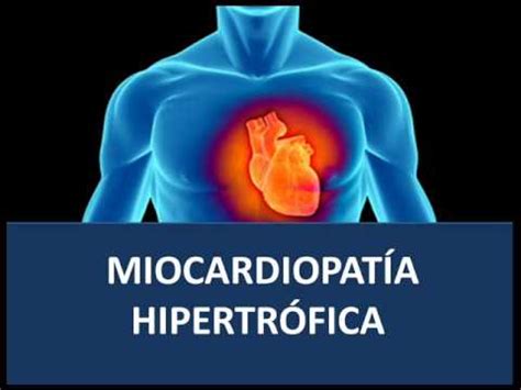 Miocardiopatía Hipertrófica Fisiopatología YouTube