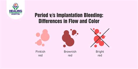 Period Vs Implantation Bleeding Differences In Flow And Color