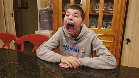 Minneapolis Teen Chomps Down On Record For Worlds Largest Mouth