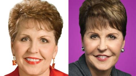 Joyce Meyers Plastic Surgery The Author Speaker Has Never Admitted To Having Cosmetic Surgery