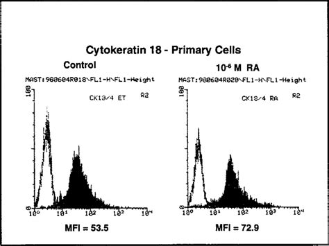 Cytokeratin 18 Expression In Primary Lacrimal Acinar Cells Detected