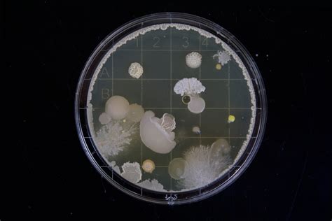 Candida Are You Experiencing Yeast Overgrowth Absolute Health Science